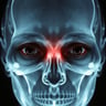 X-Ray